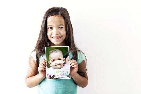 Campus Book Rentals Supports Operation Smile