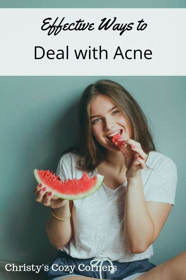 4 Effective Ways To Deal With Acne - Christy's Cozy Corners